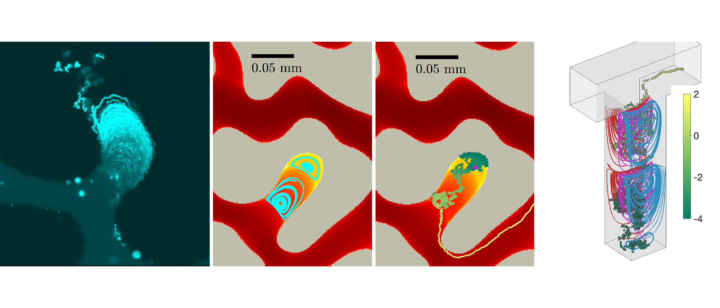 Vortices in dead-end pores